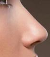 注射隆鼻能改善哪種鼻型問題